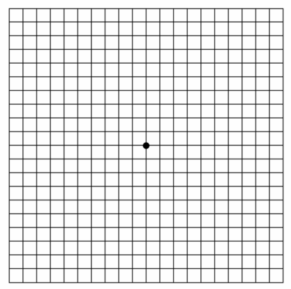 歪んで見える？セルフチェック方法