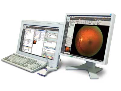 電子カルテ（ニデック社 ＮＡＶＩＳ－ＣＬ）